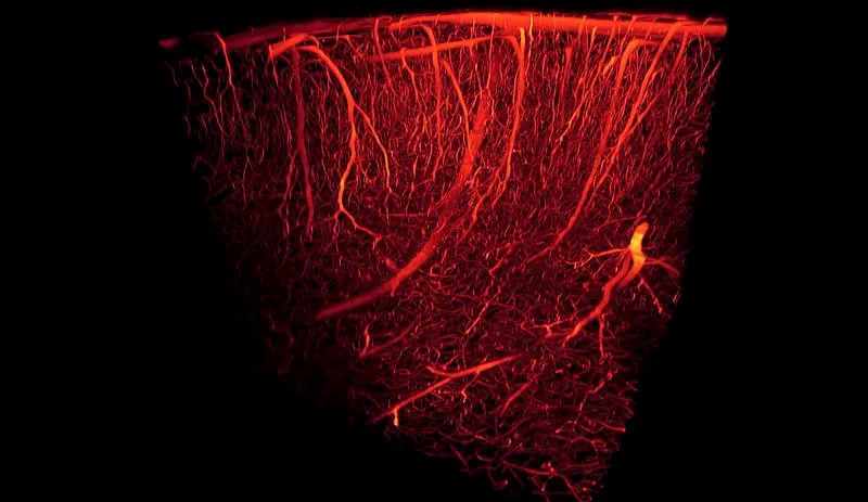 neo-angiogenesis