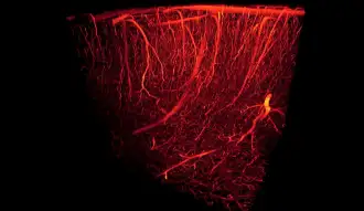 neo-angiogenesis